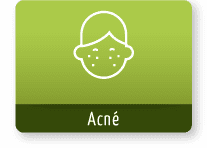 servivios acne